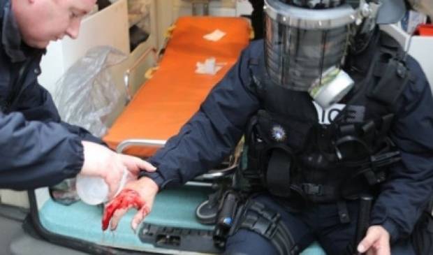 72 Polis Yaralandı, 160 Protestocu Tutuklandı