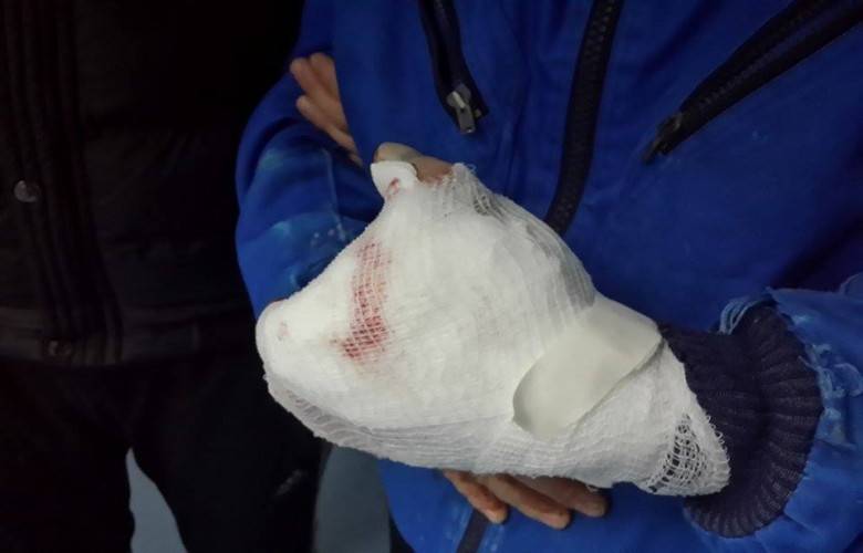 Dün Geceki Kutlamalarda 6 Kişi Yaralandı