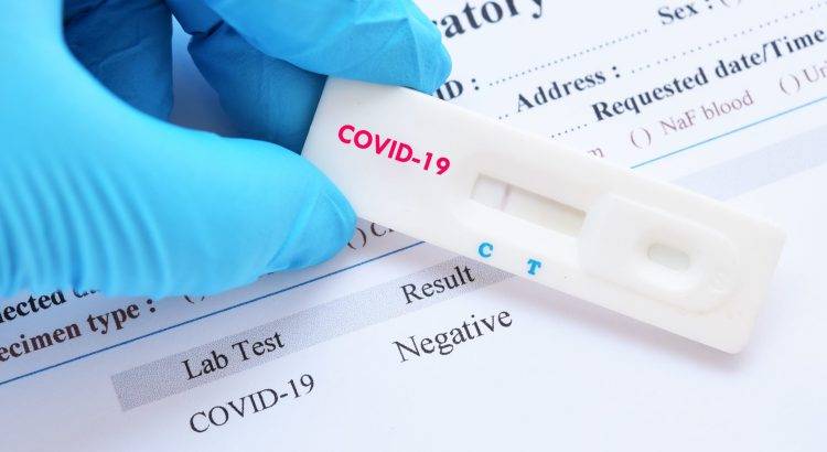 Bir Özel Laboratuvar Yasadışı Covid-19 Testi Yapıyor