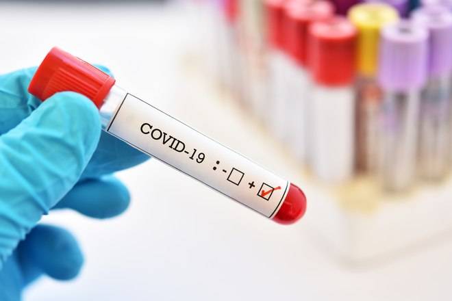 Almanya’dan 6000 Koronavirüs Test  Bağışı