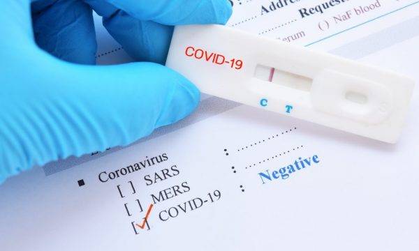 Ülkemizde 20.652 Aktif Covid-19 Vakası Bulunuyor
