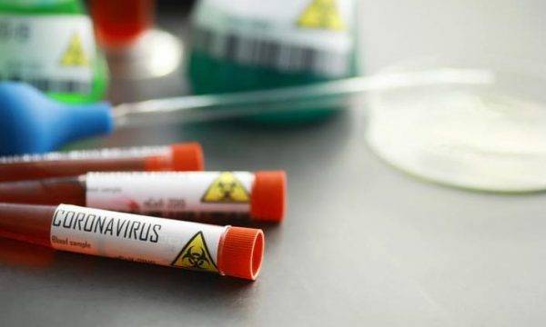 100 Özel Klinik Koronavirüs Testini Yapmak İstiyor