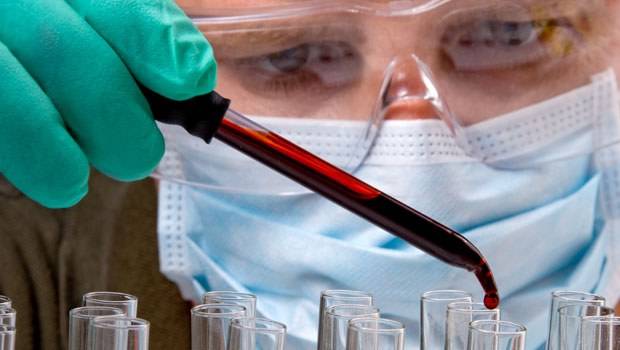 Kosova'da 27 HIV/AIDS Vakası