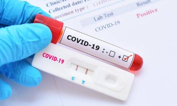 36 Yenı Covid Vaka