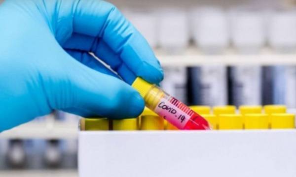 Haftaya 10 Bin Covid-19 Test Kitinin Gelmesi Bekleniyor