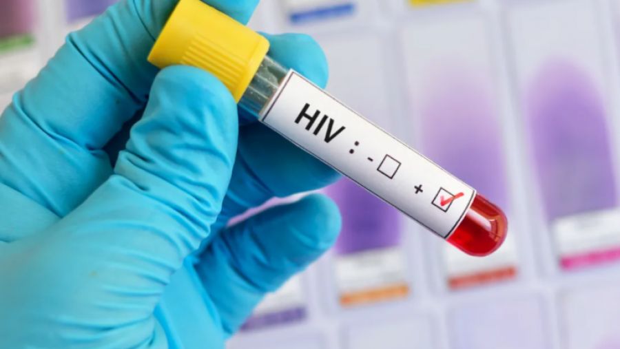 HIV Enfeksyionunu Önlemek İçin Terapi Başladı