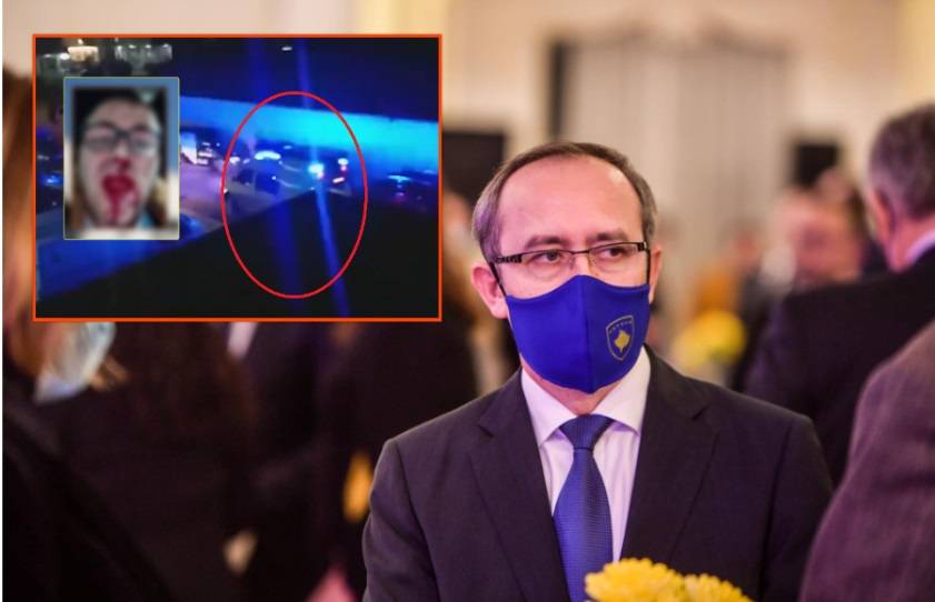 Hoti’den Gazeteci Duriqi’nin Dövülmesine Sert Tepki