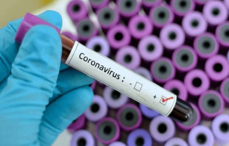 Koronavirüsten Şüpheli Kaçanik Vakası Negatif Çıktı