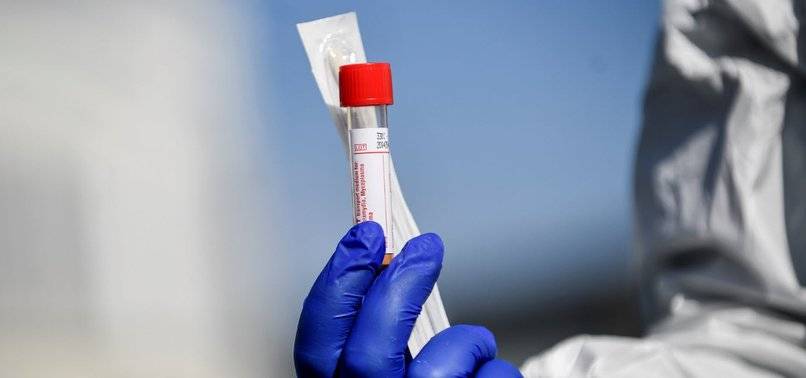 Koronavirüs Ülkemizde Bir Can Daha Aldı