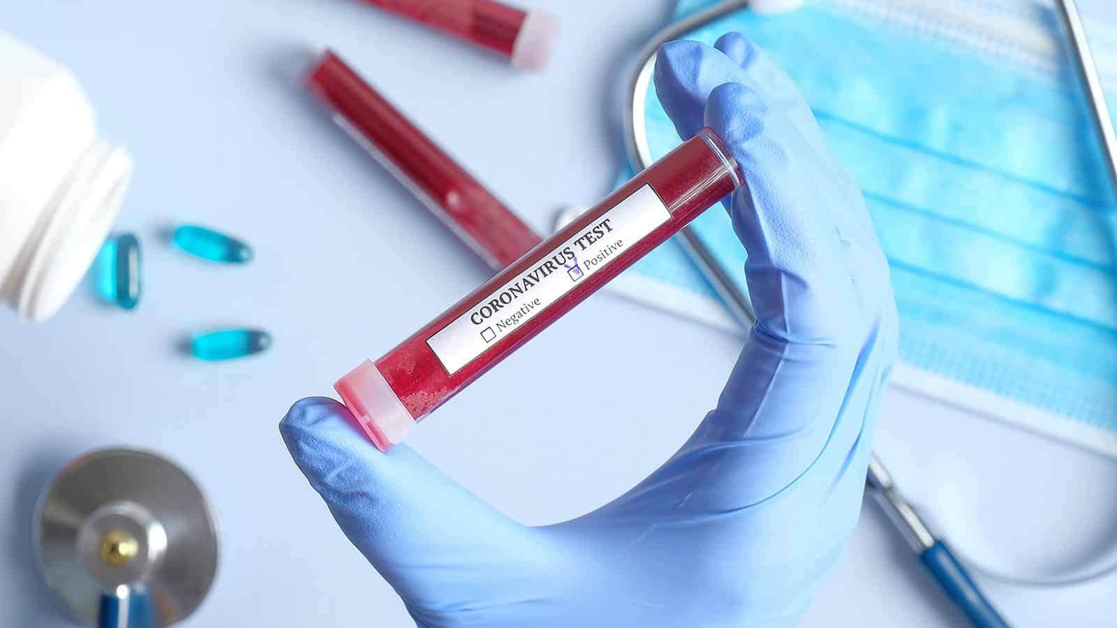 Kamenica’da  Beş Aylık Bebek Koronavirüs Vakası