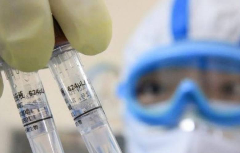 13 Numunenin Testleri Negatif