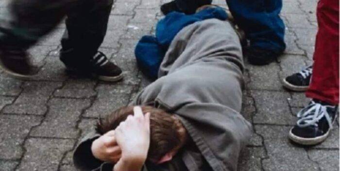 Prizren’de Bir Fas Vatandaşı Saldırıya Uğradı
