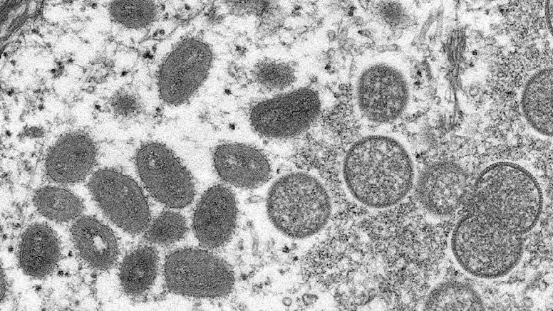 Avrupa’nın ardından ABD’de monkeypox (maymun çiçeği) virüsü alarmı
