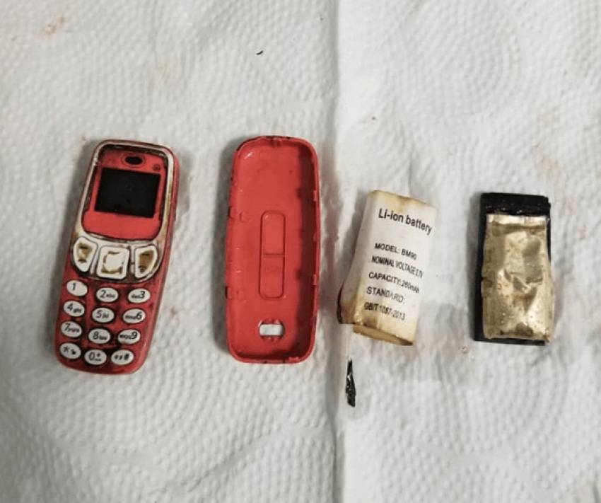 QKUK’da Midde Kesilmeden Yuttuğu Telefonu Karnından Çıkardılar