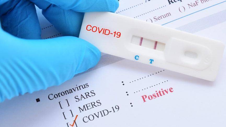 83 Yeni Covid-19 Vakası
