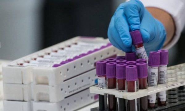 Son 24 Saatte; 74 İyileşen, 14 Aktif Vaka ve 2 Vefat